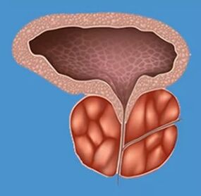 Sinais característicos de prostatite
