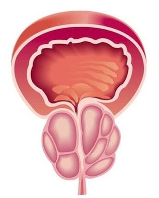 Sintomas de prostatite em homens